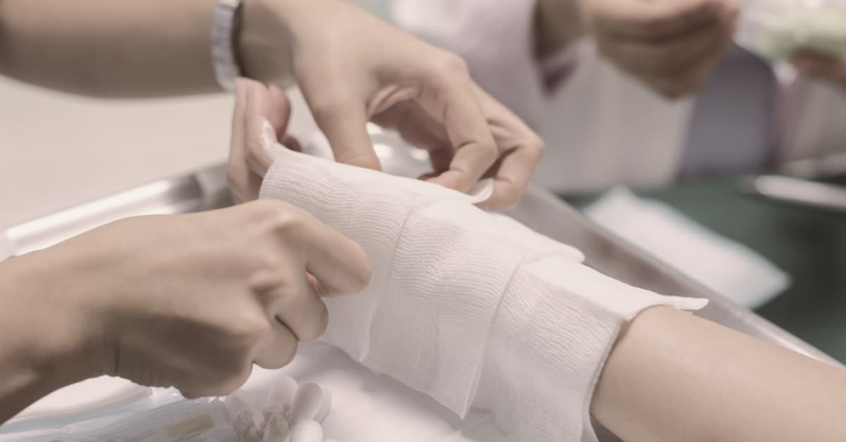 Medical professionals bandage a burn wound in a hospital | Alexander Shunnarah Trial Attorneys