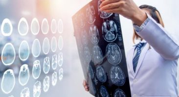 lawyer for TBI
